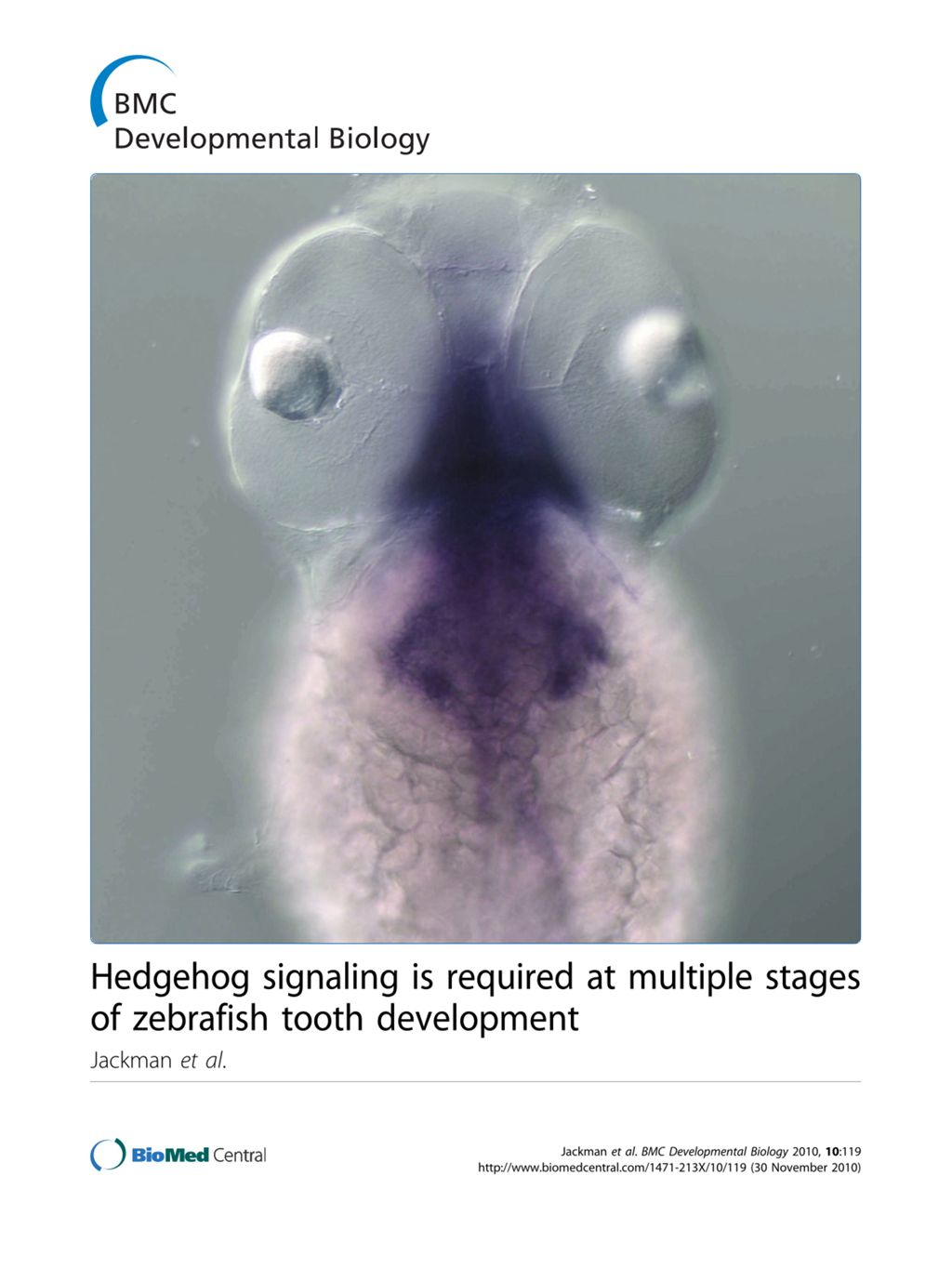 Miniature of Hedgehog signaling is required at multiple stages of zebrafish tooth development